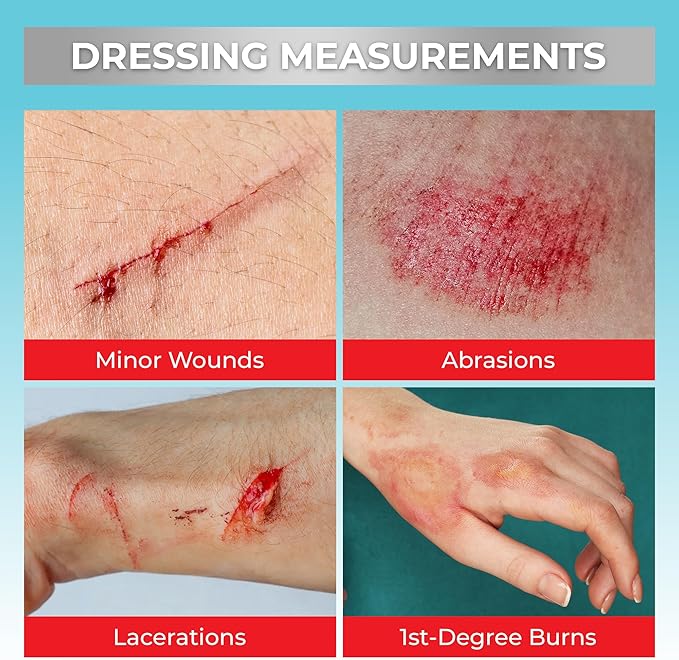 SilverSeal Hydrogel Burn & Wound Dressing Kit with X-Static Silver - FDA Cleared Care for Burns, Cuts & Wounds – Soothing Moisture, Relief & Protection - 4 (2”x3”) Hydrogels + 4 (3”x5”) Adhesive Pads